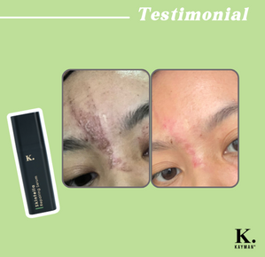 Testimonial