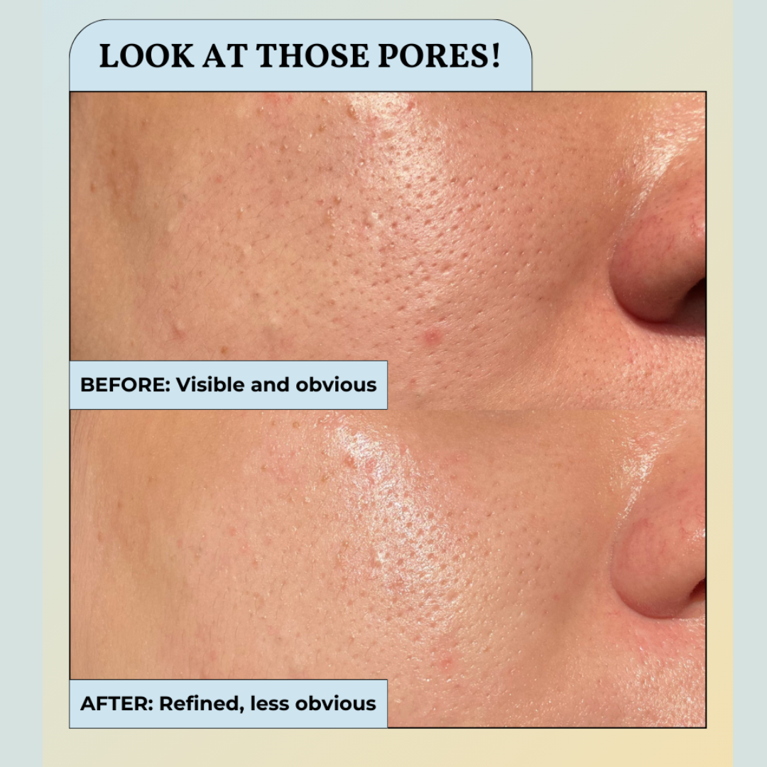 before after blumarine hydrating ampoule kayman.png__PID:93459b6b-070b-45e1-b139-2b45e89b69a2
